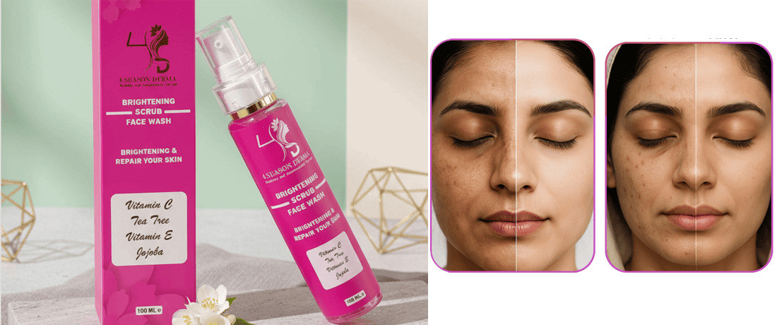 4 Season Derma promo